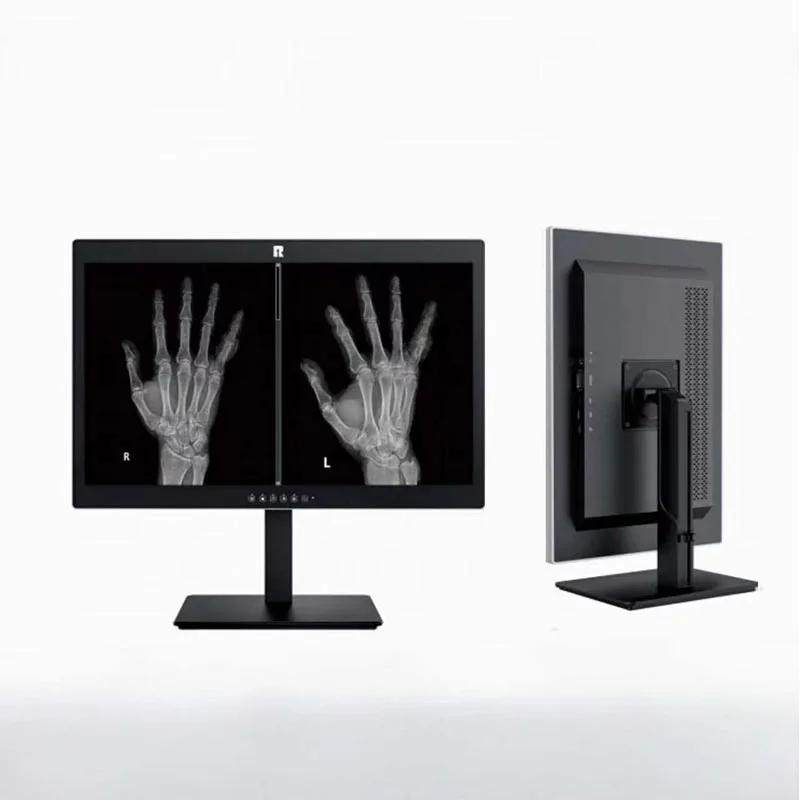 20,1-inch 2 MP medisch-diagnostisch display