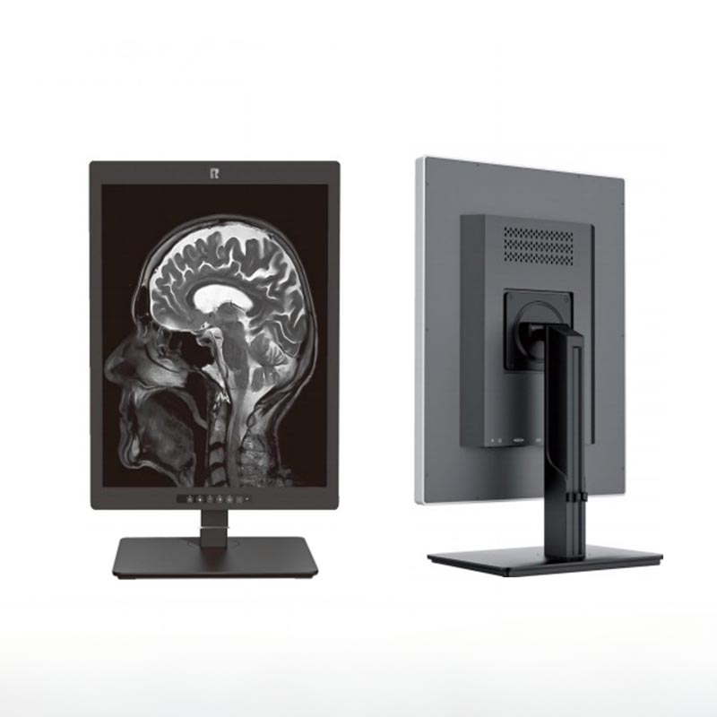 20,1-inch 2 MP medische diagnostische monitor