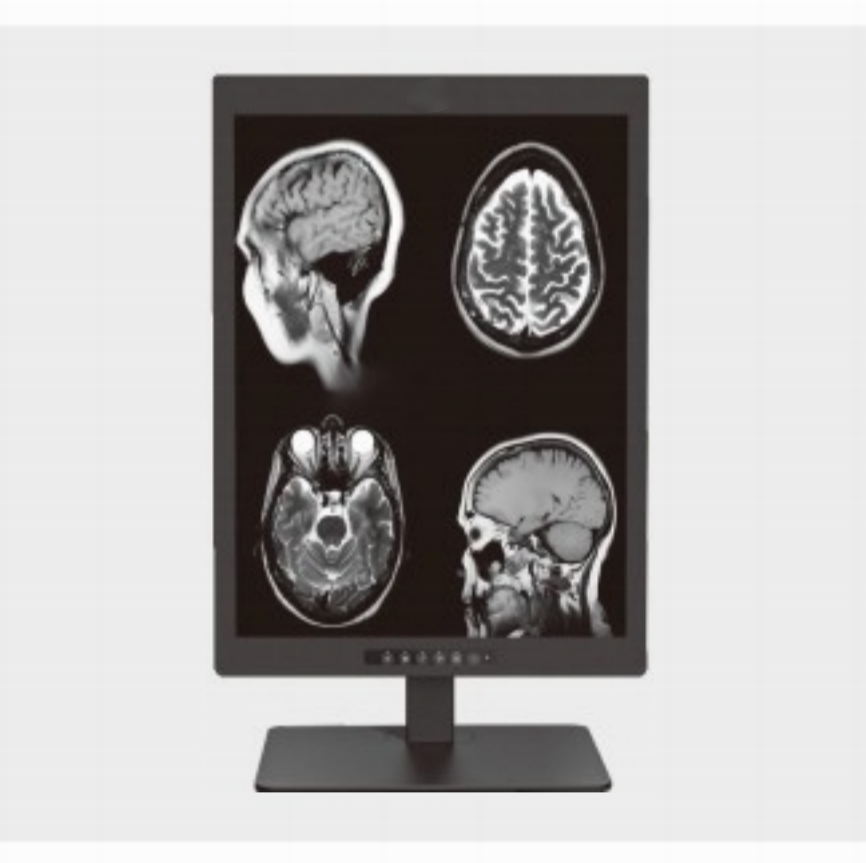 Waar wordt een 20,1-inch 2 MP medisch-diagnostisch display vaak gebruikt?