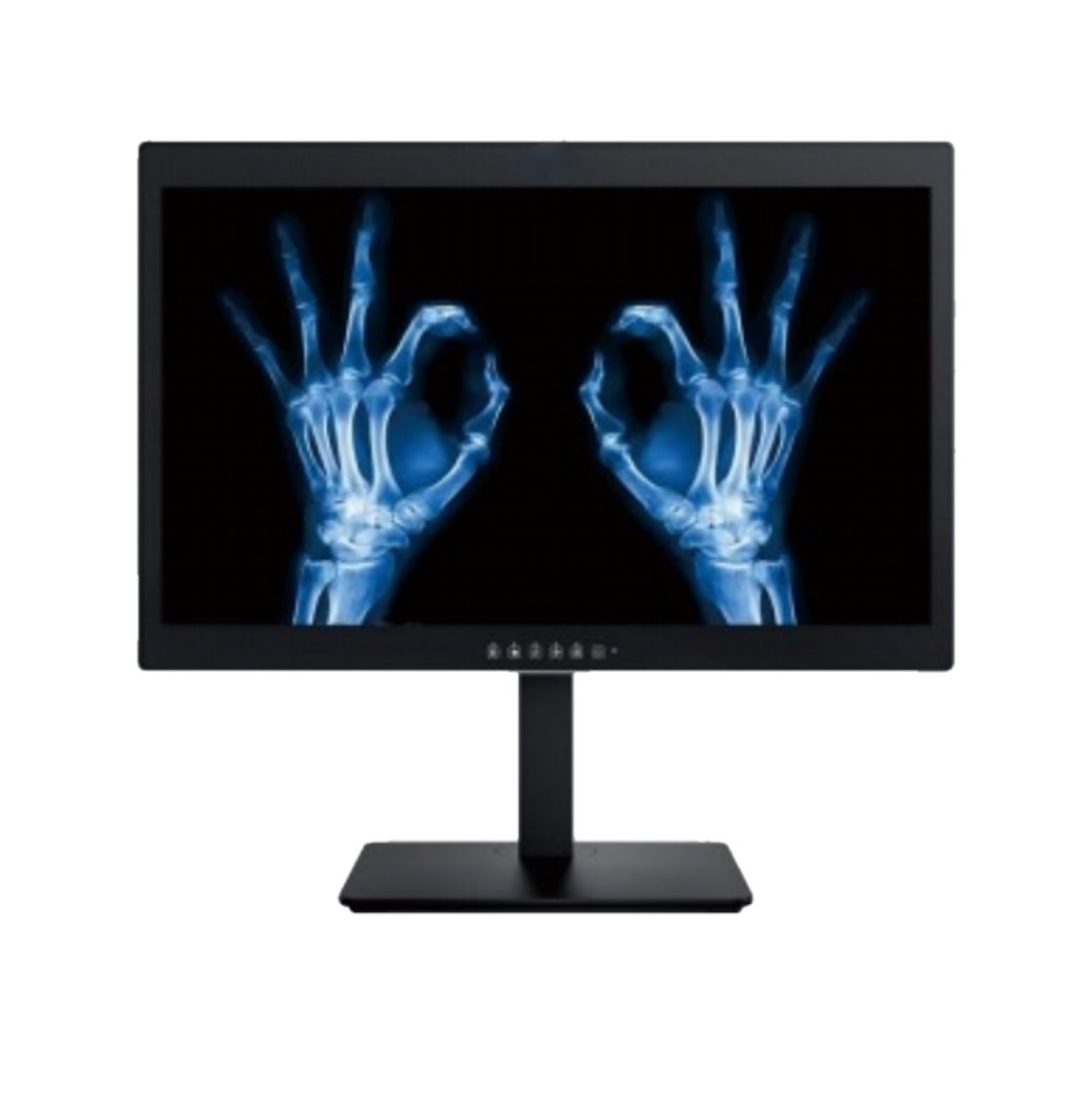 Denkt u dat 24-inch 2MP medische diagnostische beeldschermen voor ziekenhuizen slechts gewone commerciële computermonitors zijn?