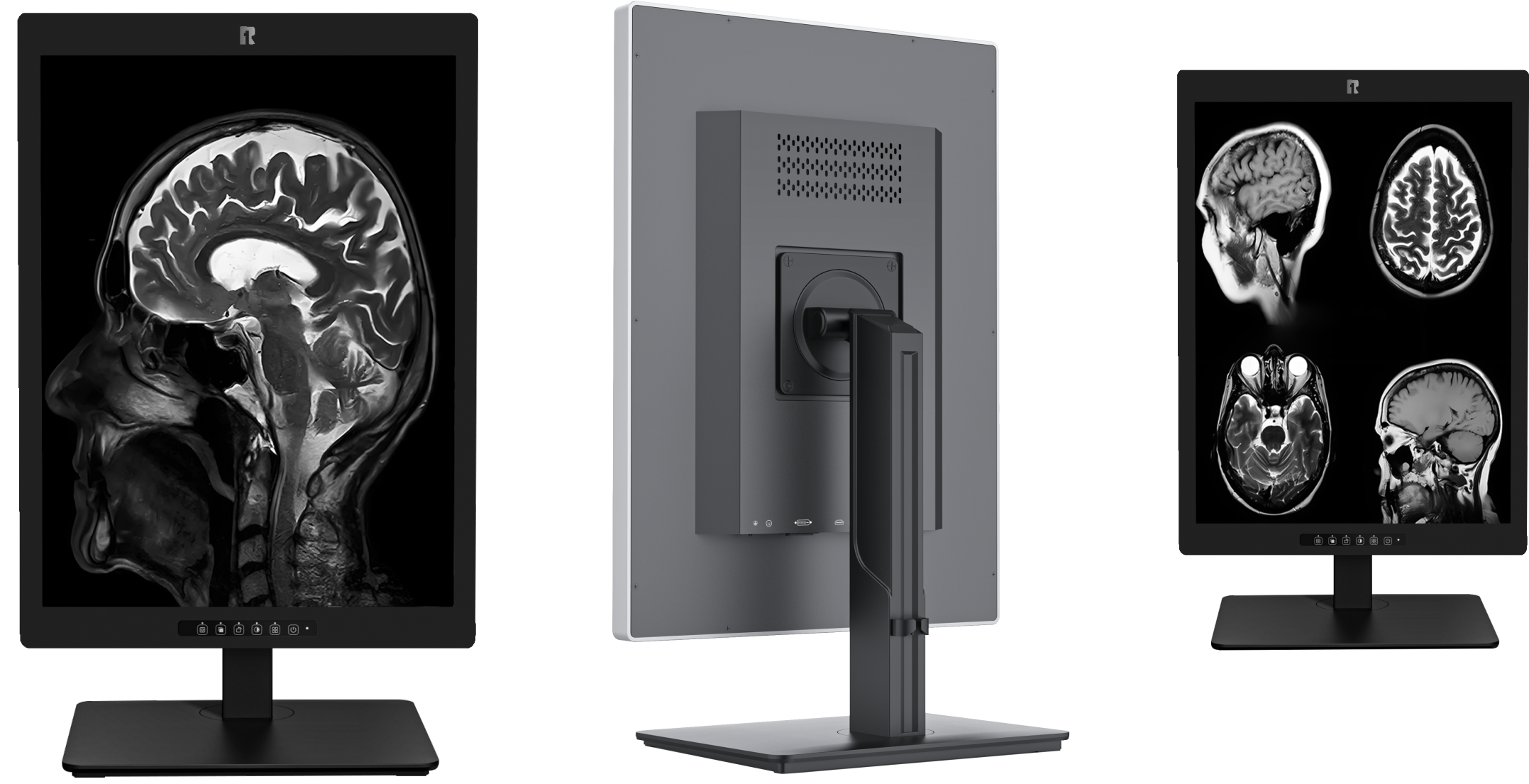 Waarom meer beeldkamers een 21,3-inch 3MP medisch diagnostisch display nodig hebben？