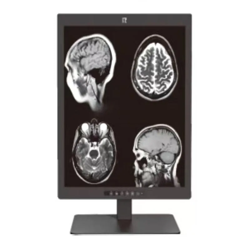 21,3-inch 3MP medisch diagnostisch display