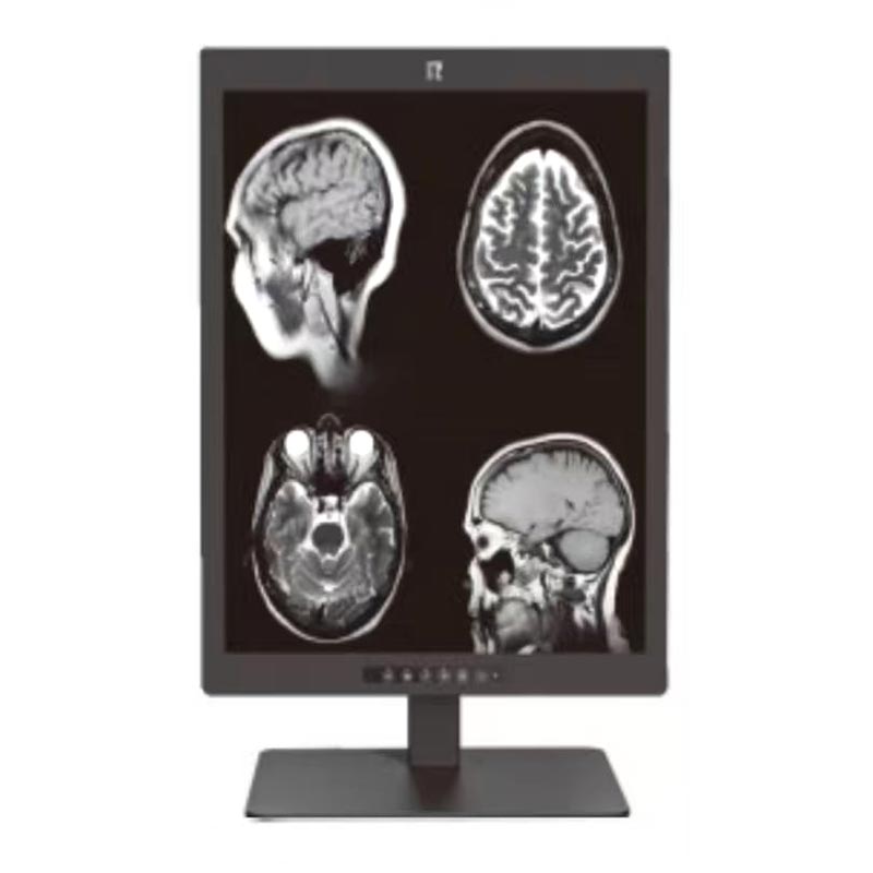 21,3-inch 3 MP medische diagnostische monitor