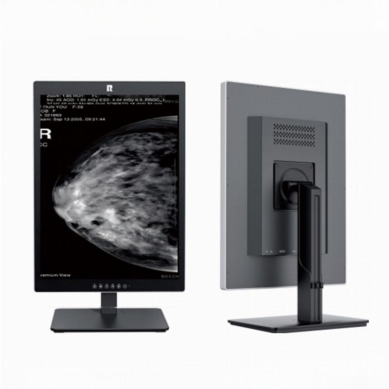 21,3-inch 5MP medische diagnostische monitor