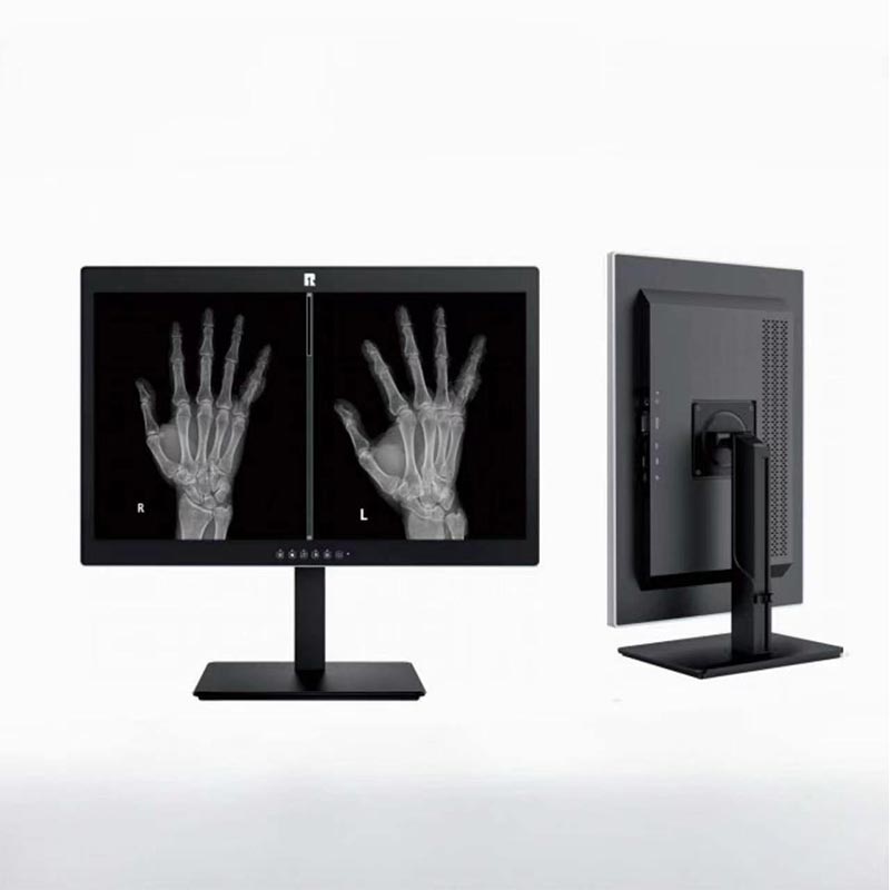 24-inch 2 MP medische diagnostische monitor