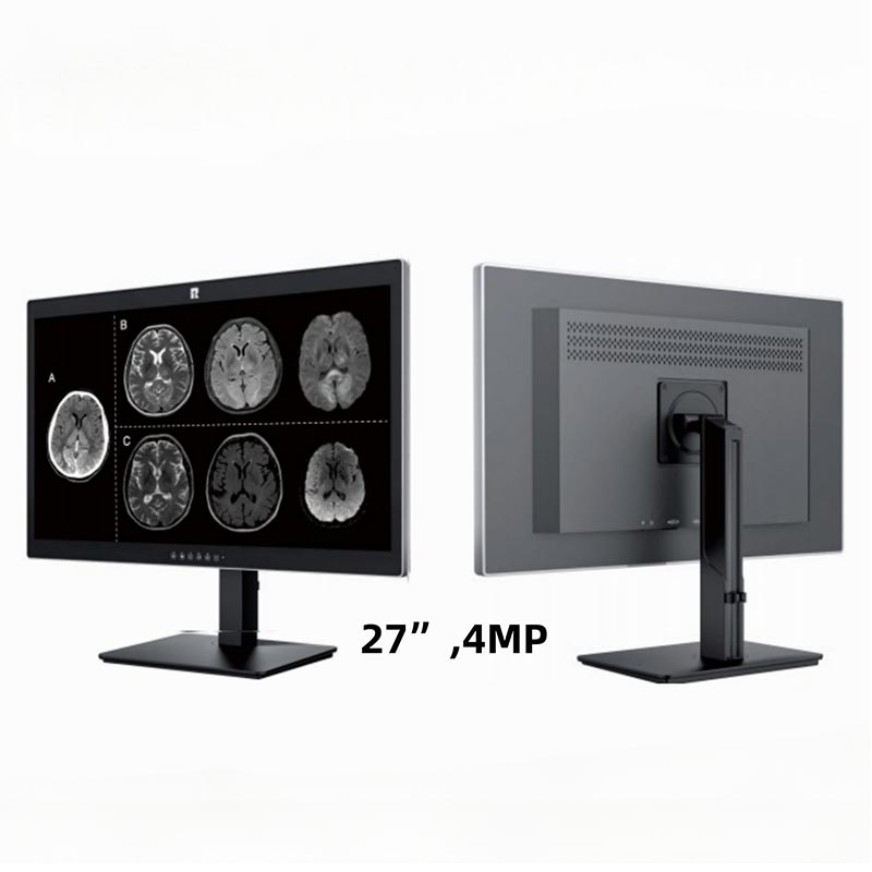 27-inch 4MP medisch diagnostisch display