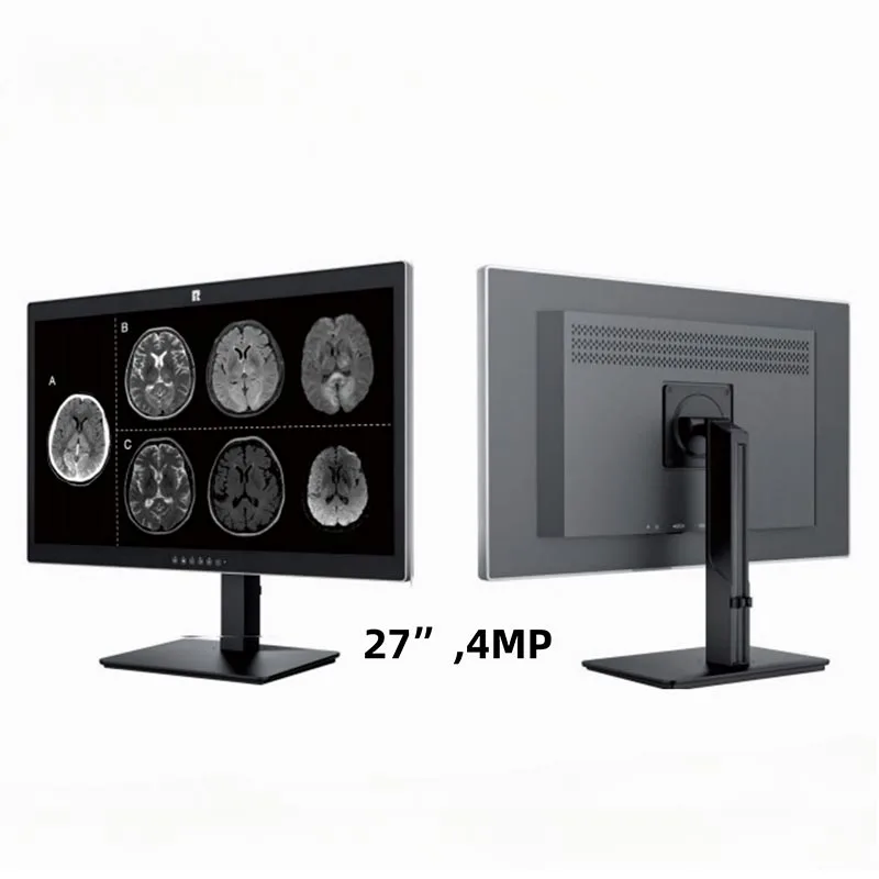 27-inch 4 MP medische diagnostische monitor