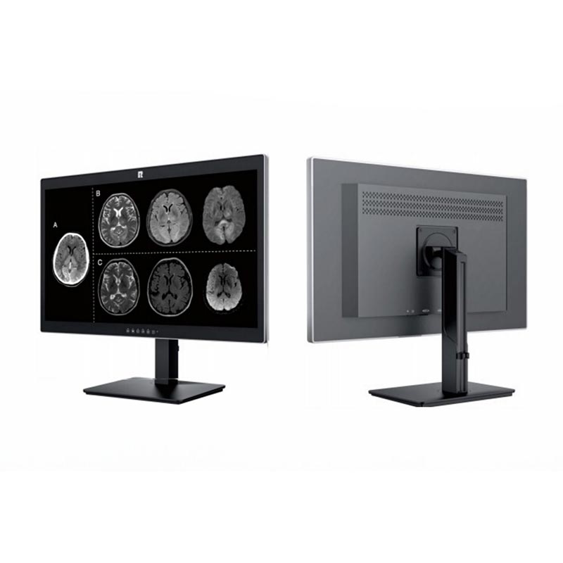 27-inch 8MP medisch diagnostisch display
