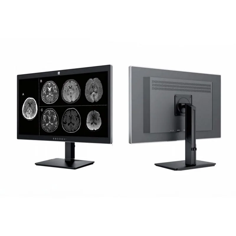 27-inch 8 MP medische diagnostische monitor