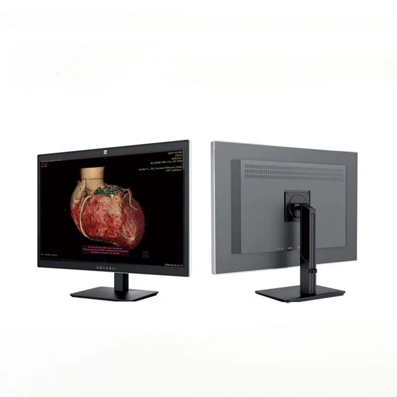 30-inch 6 MP medische diagnostische monitor