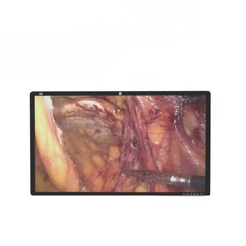 32-inch 4K chirurgische medische monitor