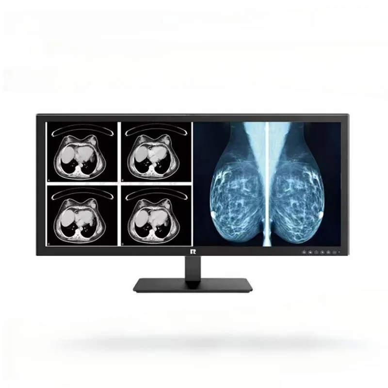 34-inch 5MP medische diagnostische monitor