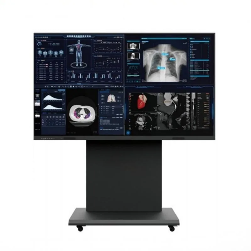 86-inch 8MP-terminal voor medische consultatiemonitor