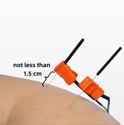 Neuromuscular Electrical Stimulation Device