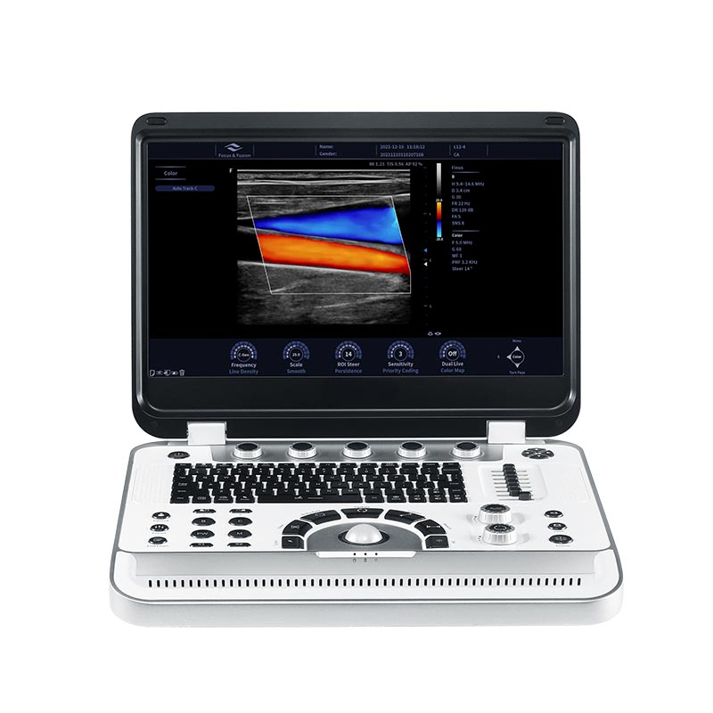 Portable Ultrasound Machine