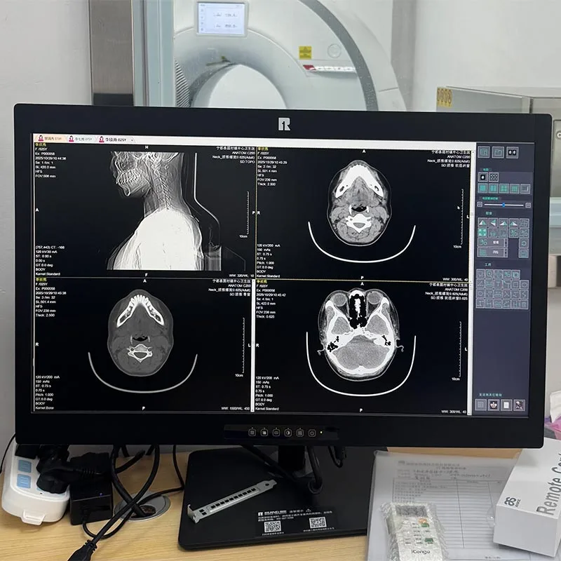 34-inch 5MP Medical Diagnostic Display